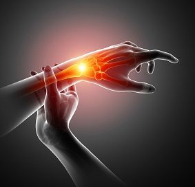  Surgery for Thumb and Digit Arthritis 